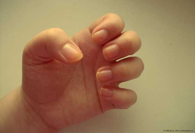 Мультивитаминный препарат для укрепления ногтей Eveline SOS Nail Therapy для мягких, тонких и расслаивающихся ногтей с кальцием и коллагеном - фото