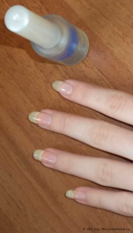 Стимулятор ускоренного роста медленно растущих ногтей Умная Эмаль с пентавитином и экстрактом женьшеня. - фото