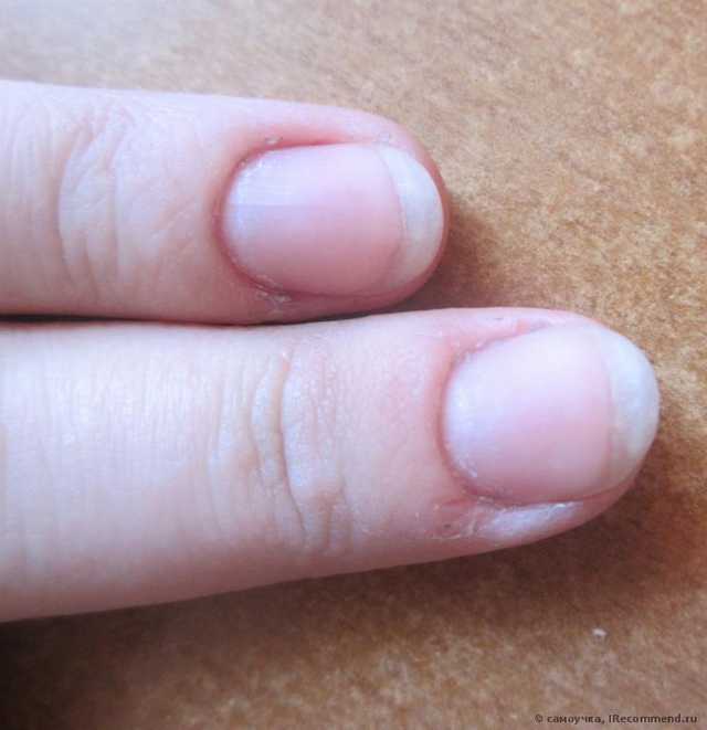 Стимулятор ускоренного роста медленно растущих ногтей Умная Эмаль с пентавитином и экстрактом женьшеня. - фото