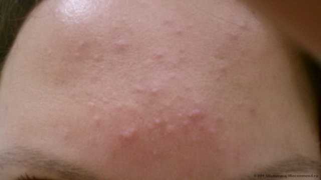 Солнцезащитный крем Floresan Крем против загара отбеливающий SPF 35 - фото