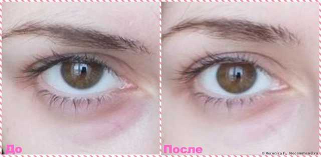 Маска для кожи вокруг глаз Белкосмекс Домашний косметолог Маска для кожи вокруг глаз Антистресс - фото