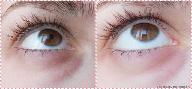 Маска для кожи вокруг глаз Белкосмекс Домашний косметолог Маска для кожи вокруг глаз Антистресс - фото