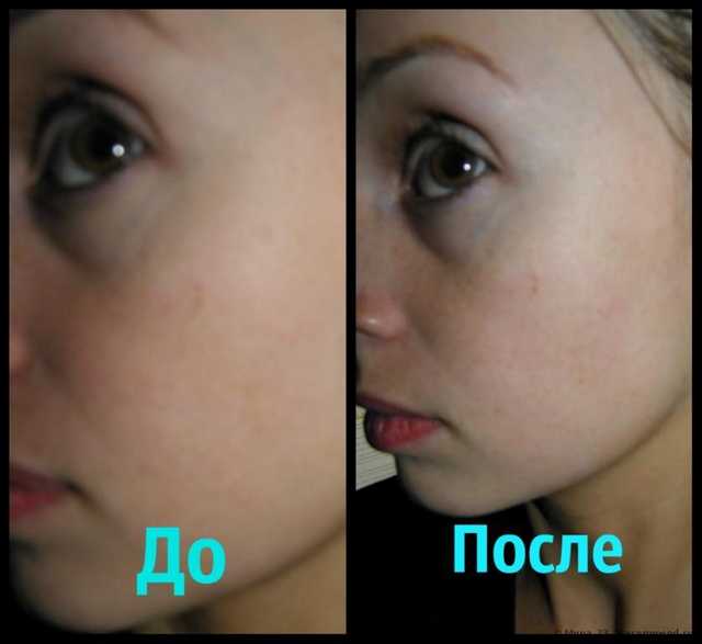 До и после