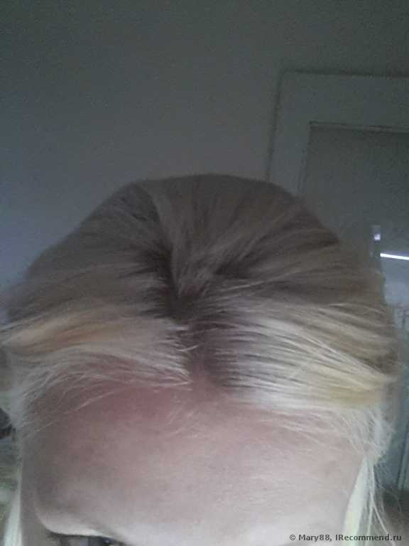 Волосы после Тоники (помыла 4 раза)