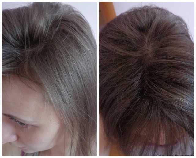 Ампулы для волос Vichy Aminexil pro - фото