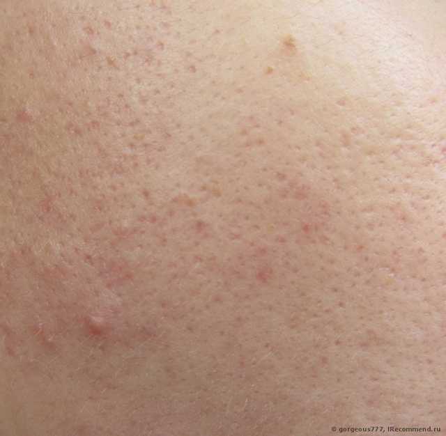 всегда буду её брать!+качественные фото нескольких оттенков+ФОТО НА КОЖЕ
