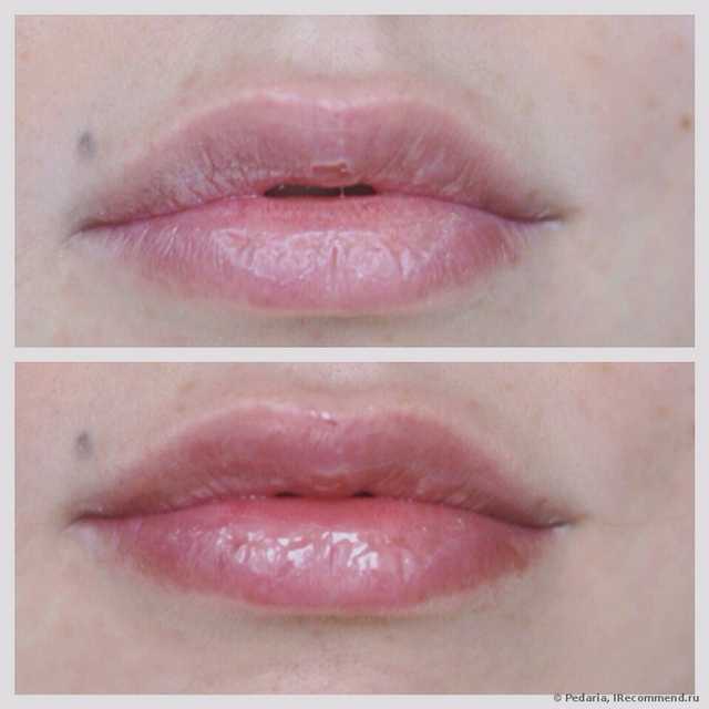 Бальзам для интенсивного ухода за губами Almea Xlips EFG - фото