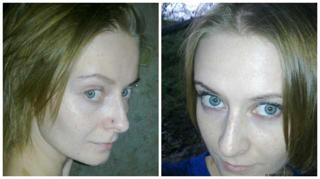 фото До и После. На втором фото крем на лице уже более 8 часов