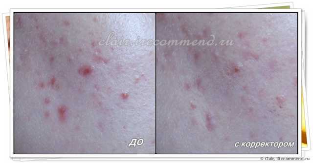 Корректор  Л'Этуаль NUANCE Correcteur Camouflage Perfecton Mate - фото