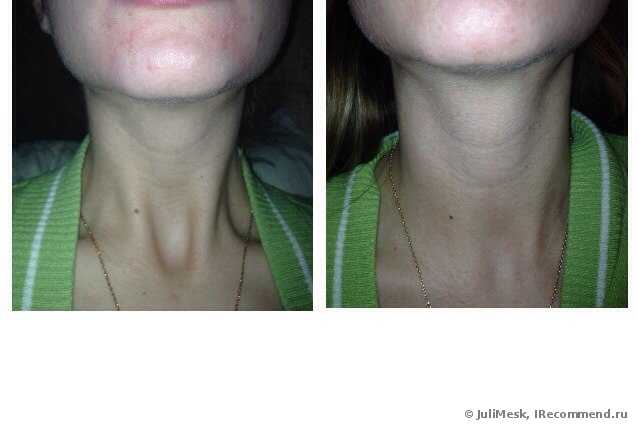 Гель для умывания Avene Clean-Ac - фото