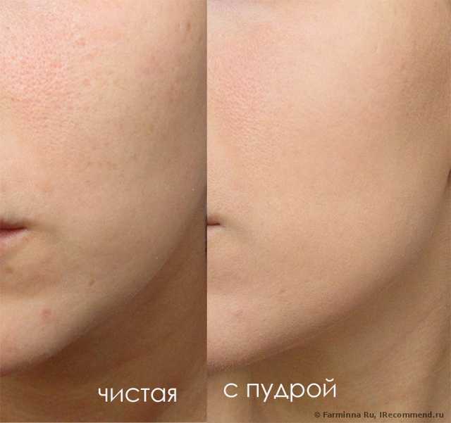 поймала на солнышке все что можно было и нельзя, зато максимально видна разница до и после