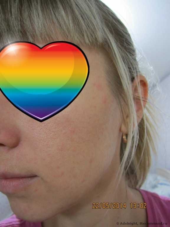 И это с тобой сделали за деньги???!!! Кошмар! (наконец, добавила фото)