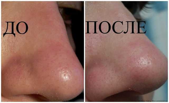 Теперь я знаю, зачем нужен косметолог.