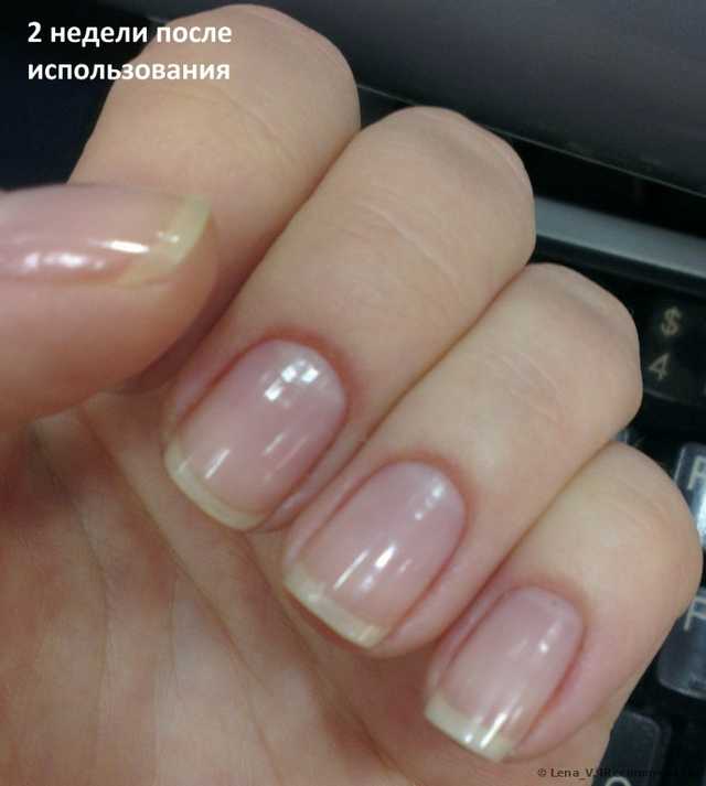 Как разорить салоны по наращиванию ногтей
