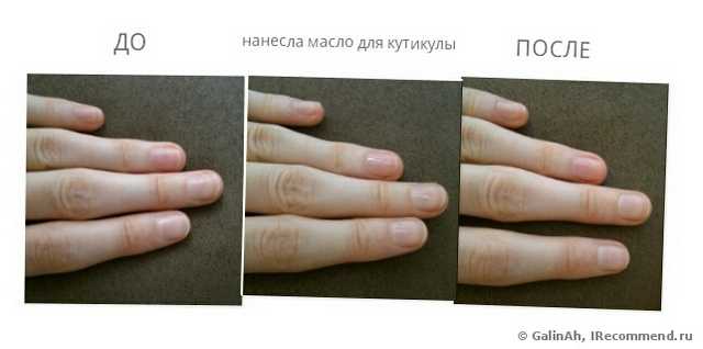 А все-таки классные эти палочки для удаления кутикулы. Очень практичная и нужная для ногтей вещь! + фото ДО и ПОСЛЕ