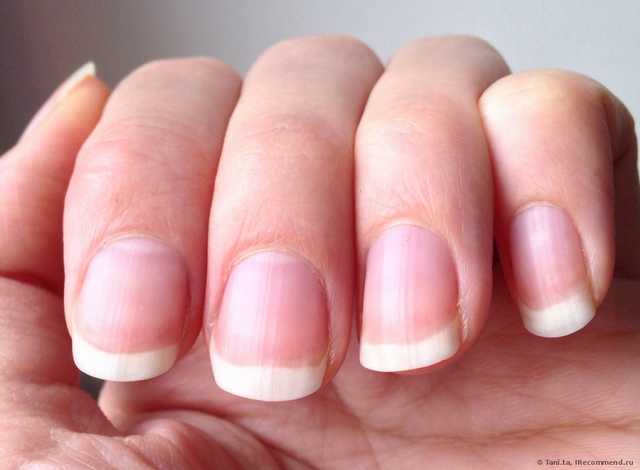 Как укрепить и восстановить слоящиеся ногти всего за 12 дней? Фото ногтей до и после + совет-предостережение