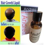 Масло для волос Aliexpress   Andrea Hair Growth Essence Hair Loss Liquid 20ml dense hair free shipping