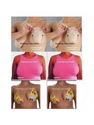 Подтяжка груди Bare and lifts Bare and lifts мгновенная подтяжка груди Подтяжка груди Bare and lifts Bare and lifts мгновенная подтяжка груди