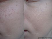 ВВ крем Mentholatum Acnes (без SPF)