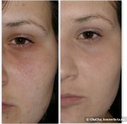 Тональный крем CLINIQUE Superbalanced Makeup Тональный крем CLINIQUE Superbalanced Makeup