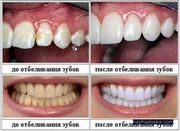 Домашнее отбеливание зубов  Масло вытягивание