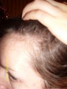 Шампунь PHARMA GROUP от интенсивного выпадения волос