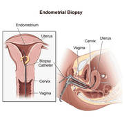 Биопсия эндометрия ( аспират)